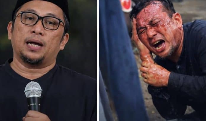 Dugaan Andrie Yunus Disiram Air Keras, Feri Amsari Desak Negara Usut Tuntas Andrie Yunus